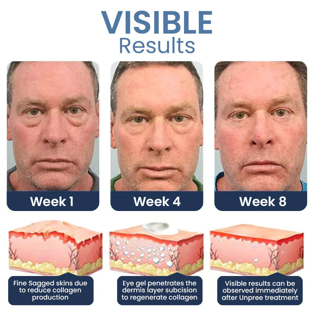 EYSEL™ Peptide Depuffing Eye Serum